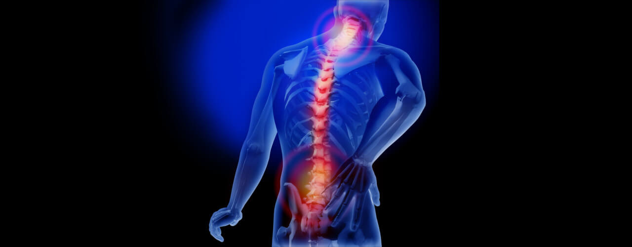 Back & Sciatica Pain Relief Scarsdale, NY