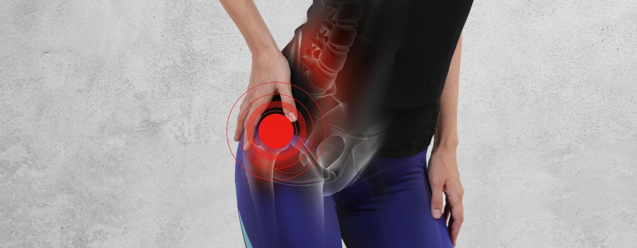 Hip Exercises - Sports Injury & Pain Management Clinic of NYC